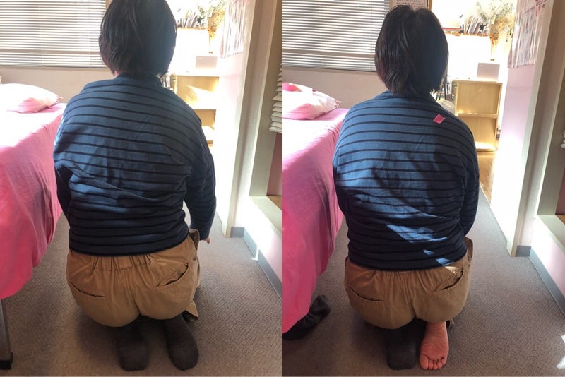 背中・姿勢の変化例